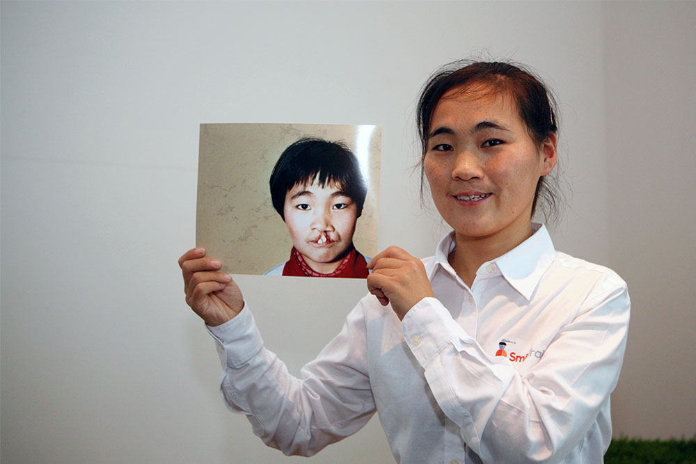 Wang Li holds up her before picture