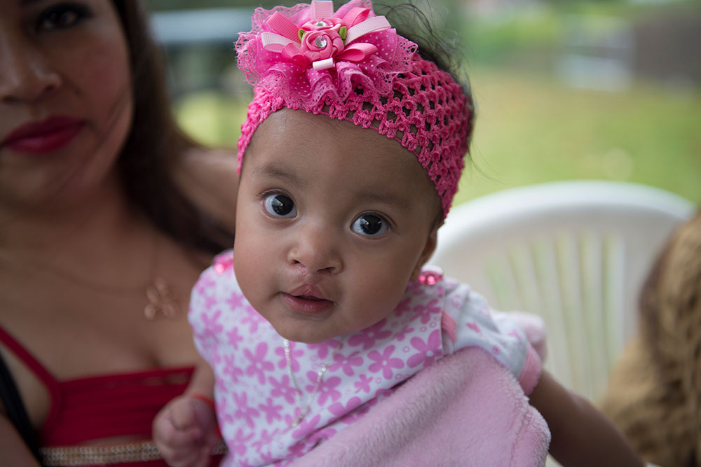 Cleft patient smiles in pink