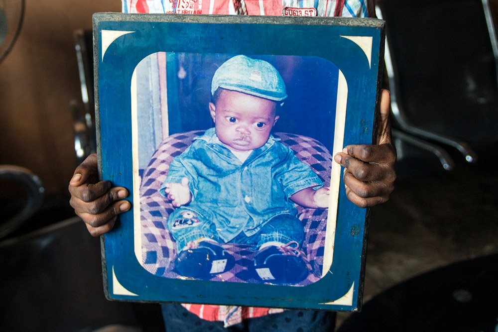 Ebuka as a child before cleft surgery