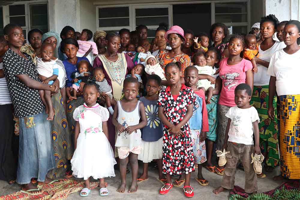 Group of children with cleft in dr congo