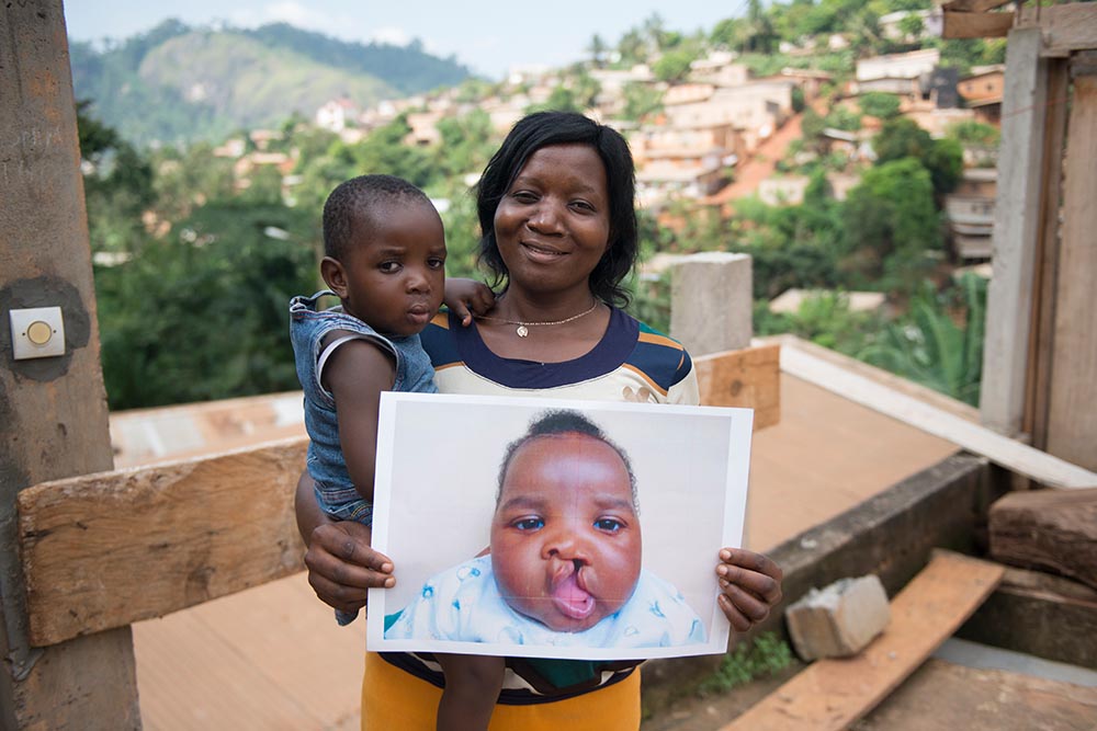 Violet's mom holds image before cleft surgery