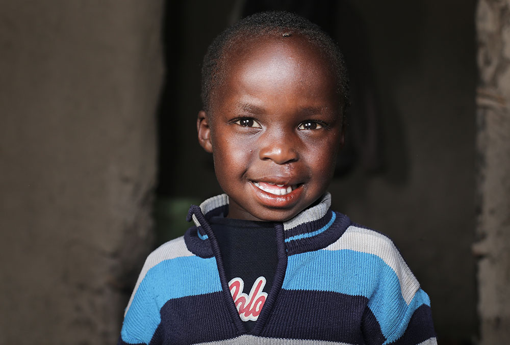 Benjamin smiles after cleft surgery