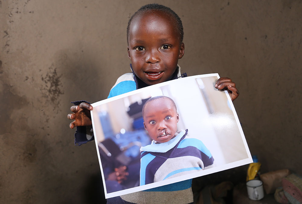 Benjamin holds up an image of himself before cleft surgery