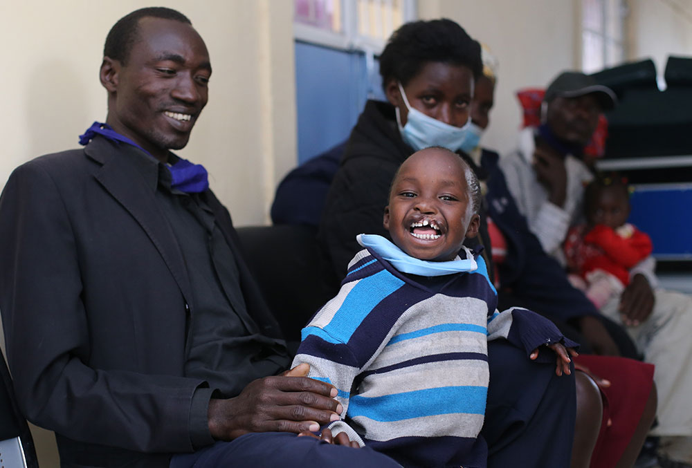 Benjamin smiles before his cleft surgery