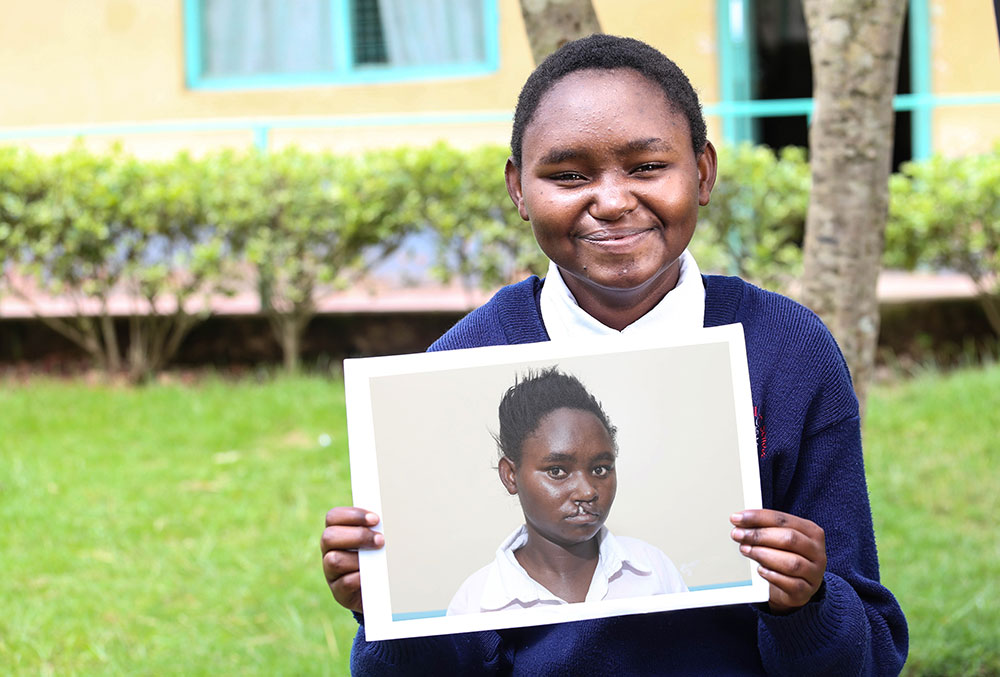 Damaris holds a photo of herself before surgery