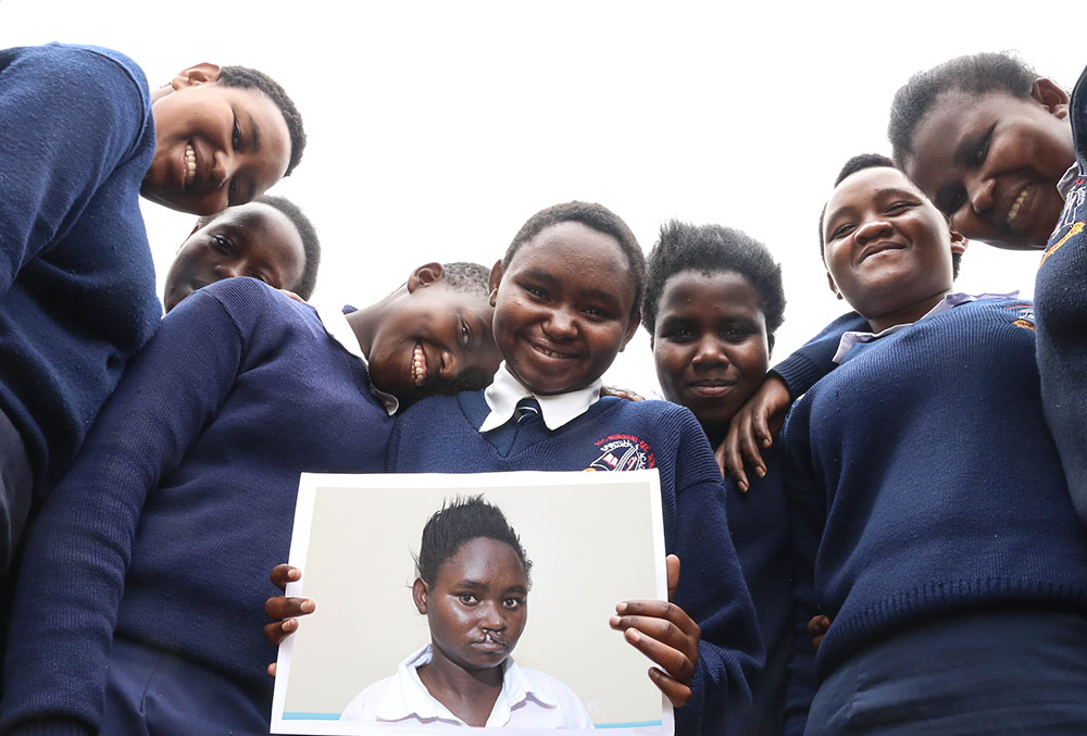 Damaris holds a photo of herself before surgery