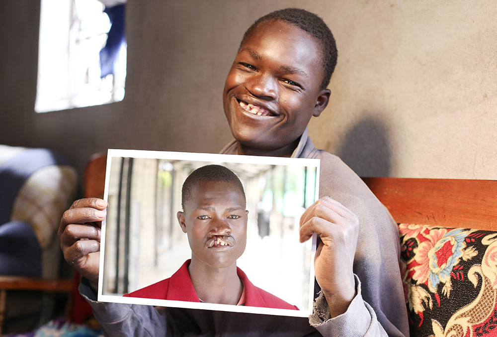 Kioko smiling while holding a picture of himself before cleft surgery