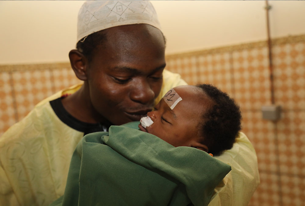 Amissou holds Mouhamed moments after his cleft surgery