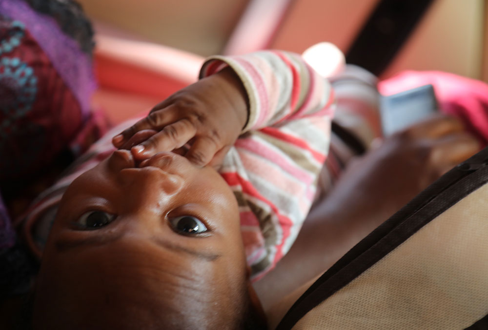 Mouhamed looking up at the camera just before his free Smile Train-sponsored cleft surgery