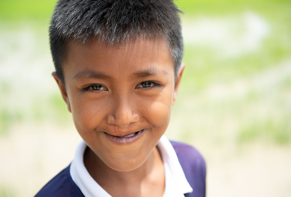 Close up of Sokim after free Smile Train-sponsored cleft surgery in Cambodia