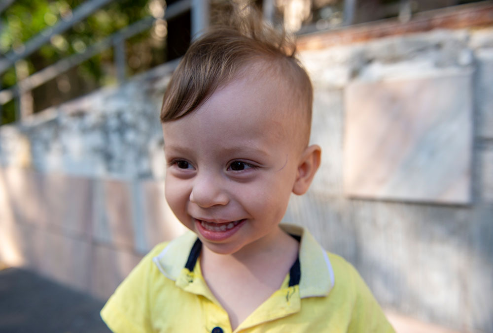 Ionut smiling after cleft surgery