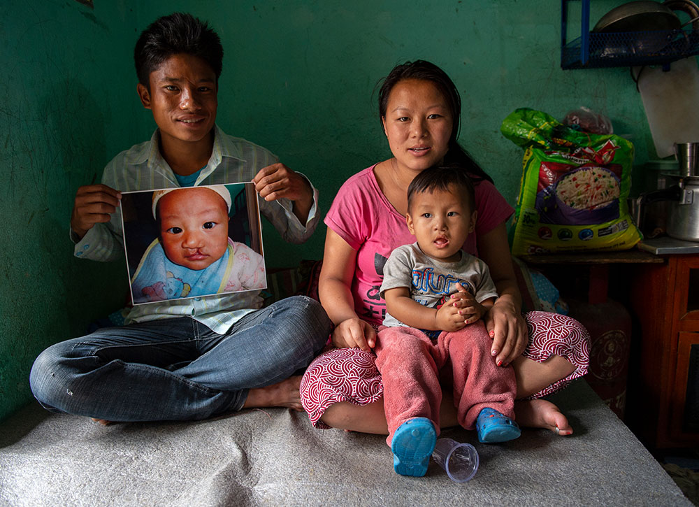 Smile with his family. His dad holds an image of him before Smile Train-sponsored cleft surgery
