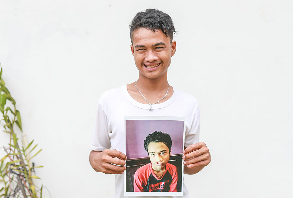 Angga holding a picture of himself before cleft surgery