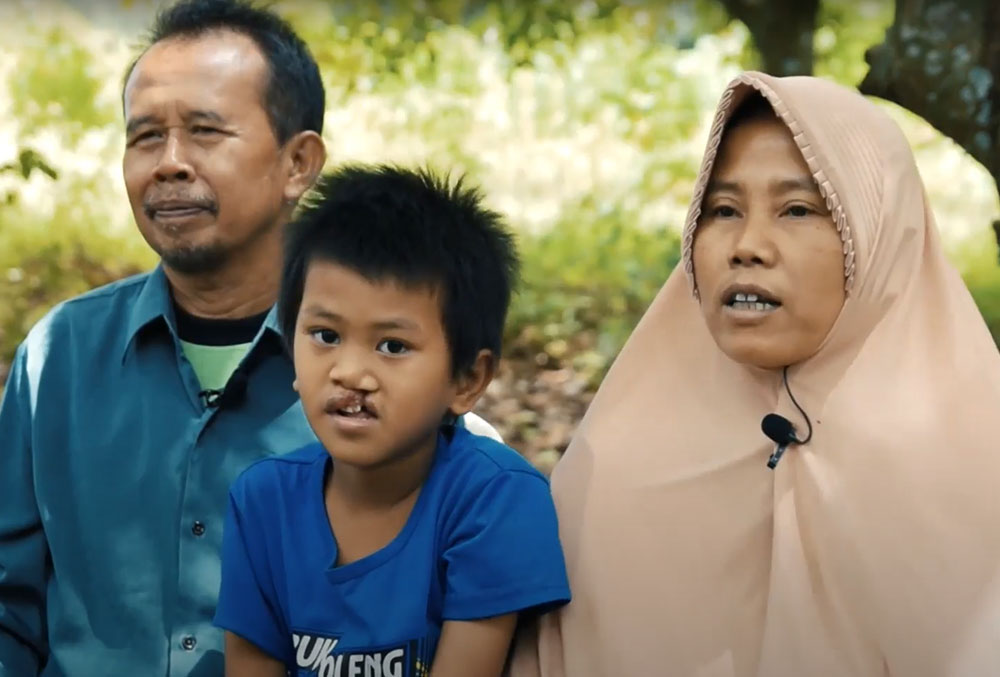 Anugrah with his parents before his cleft surgery