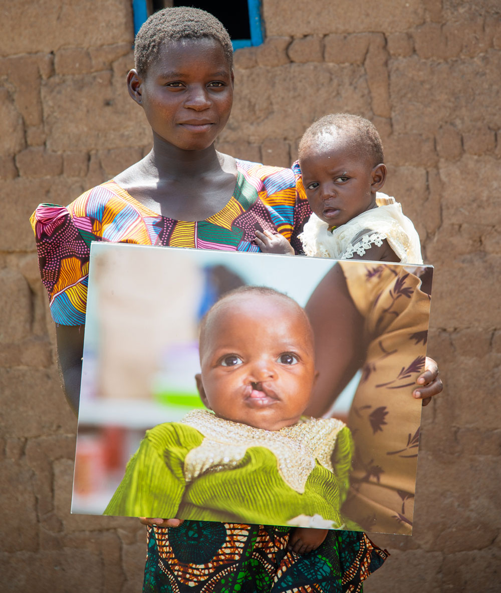 Regina holding Prisca and a picture of her before cleft surgery