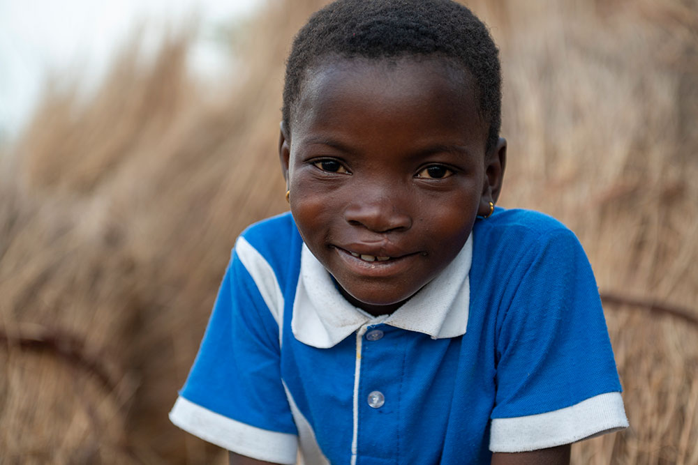 Akuya smiling after cleft surgery