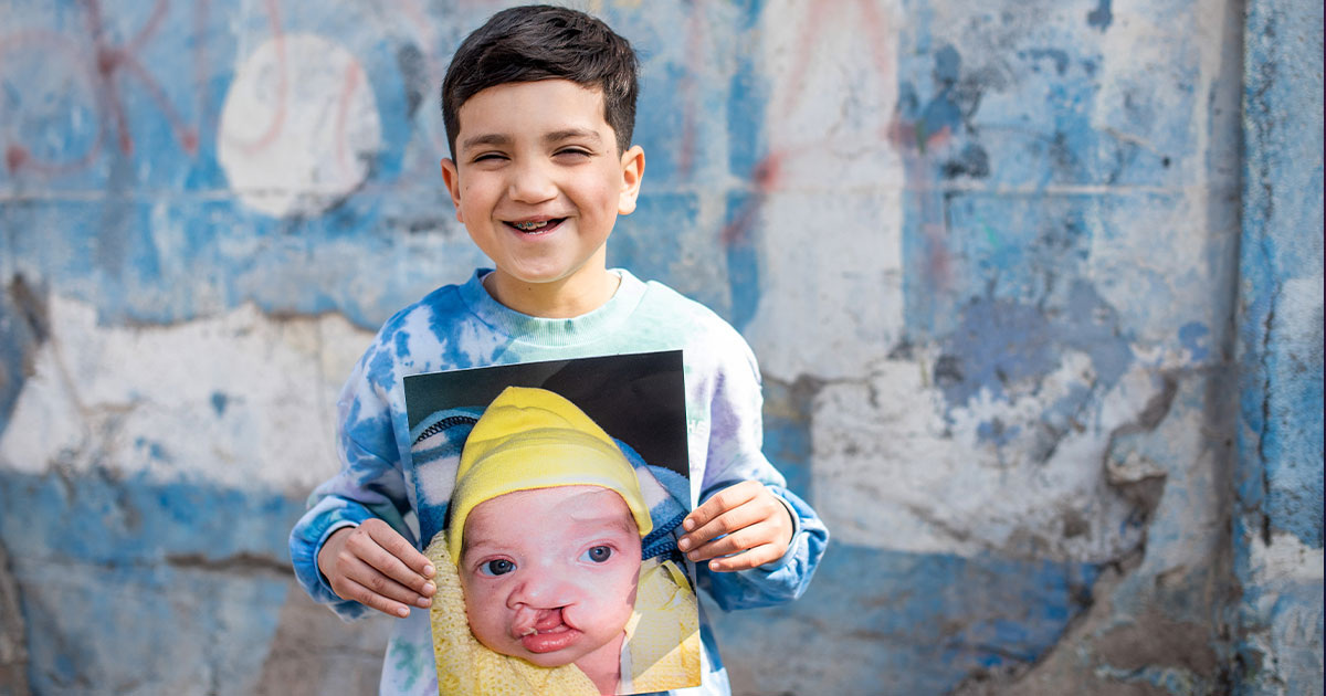 Joaquin holding a picture of himself as a baby, before cleft surgery