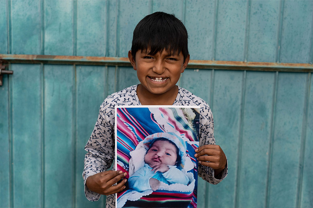 Luis holding a picture of himself before cleft surgery