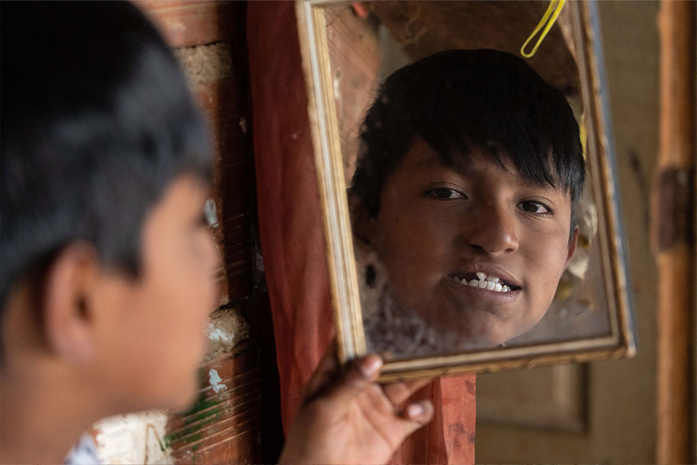 Luis looking in a mirror after cleft surgery