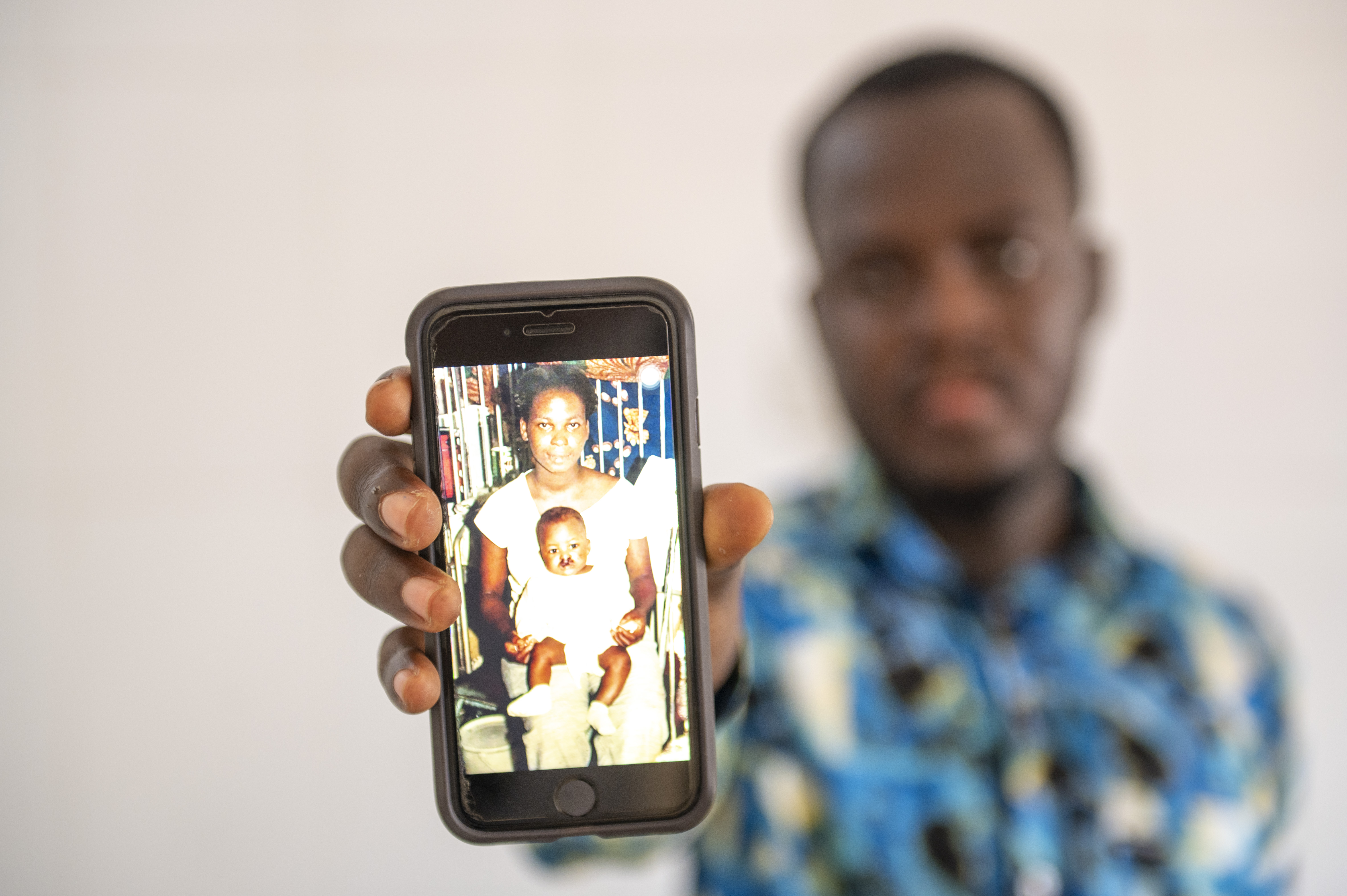 Kelvin holding a photo of himself as a baby, before cleft surgery
