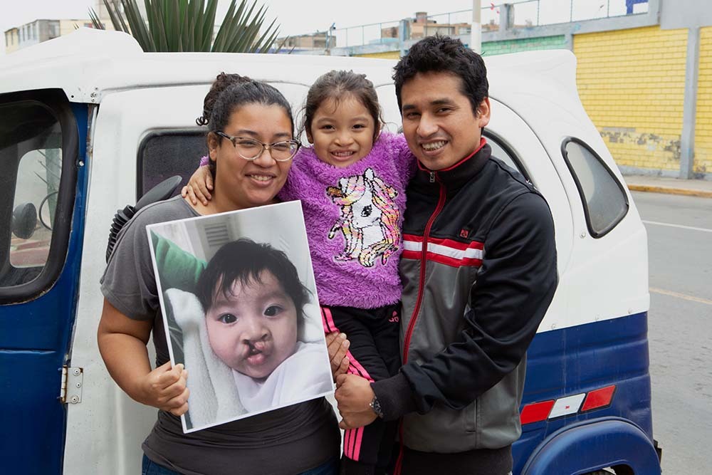 Itzayana and her parents holding a photo of her before cleft surgery