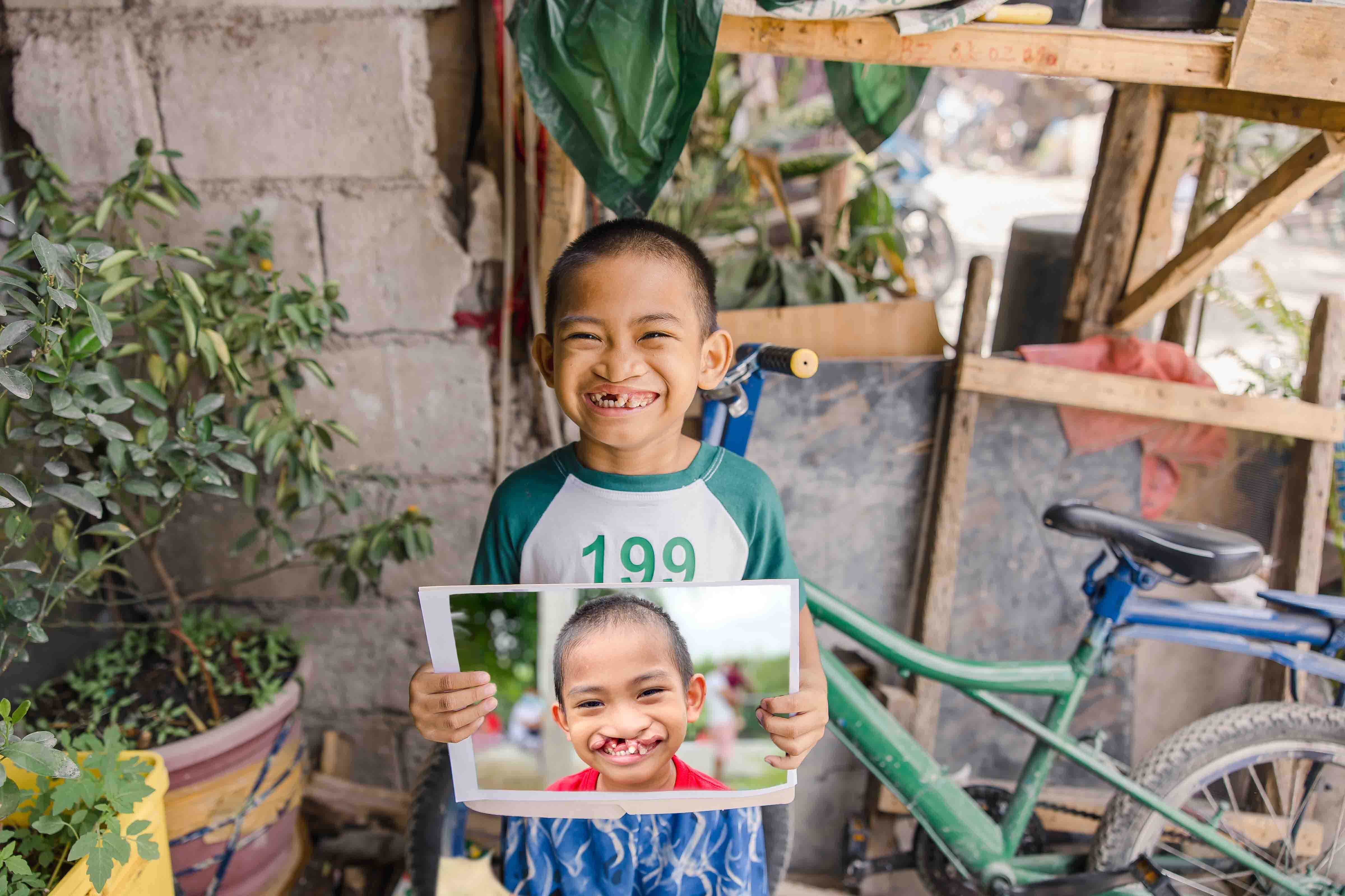 Kyle holding a photo of himself before cleft surgery