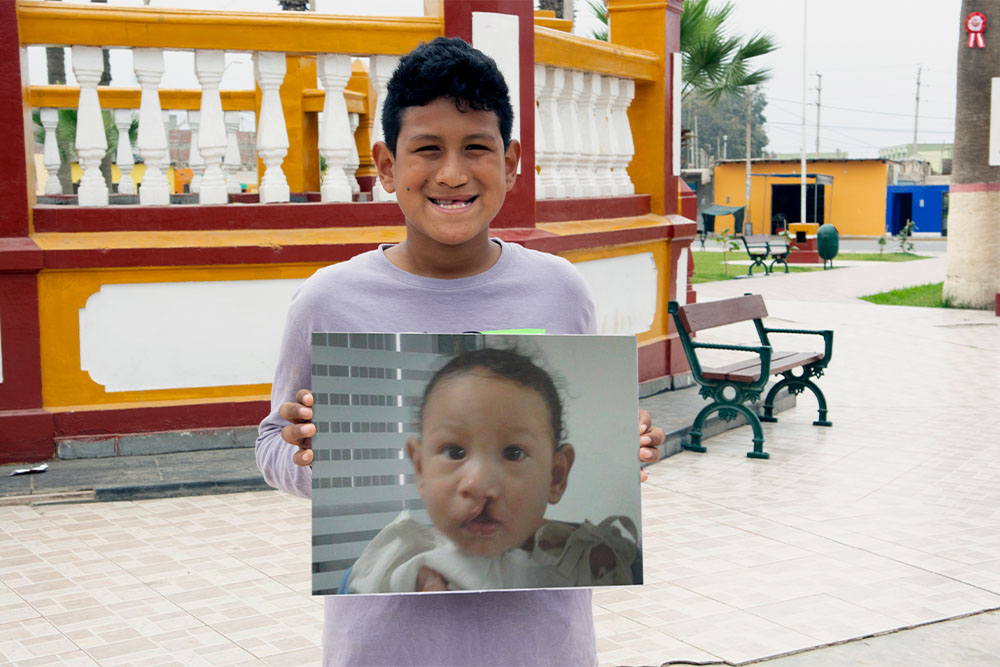 Imanol holding a picture of himself as a baby before his cleft surgeries