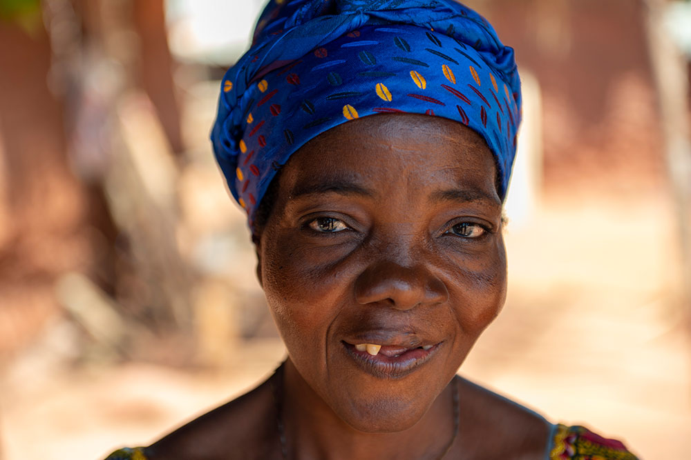 Close-up of Adjoa smiling after cleft surgery