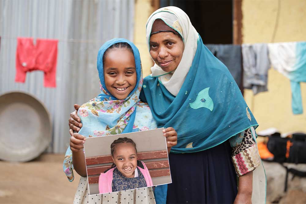 Mariam and her mother holding a photo of Mariam before cleft surgery