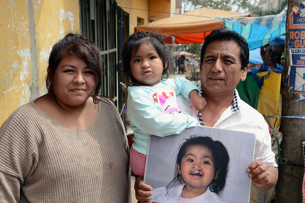 Shaymi in her grandfather’s arms as he holds a picture of her before cleft surgery. Maria stands to their left