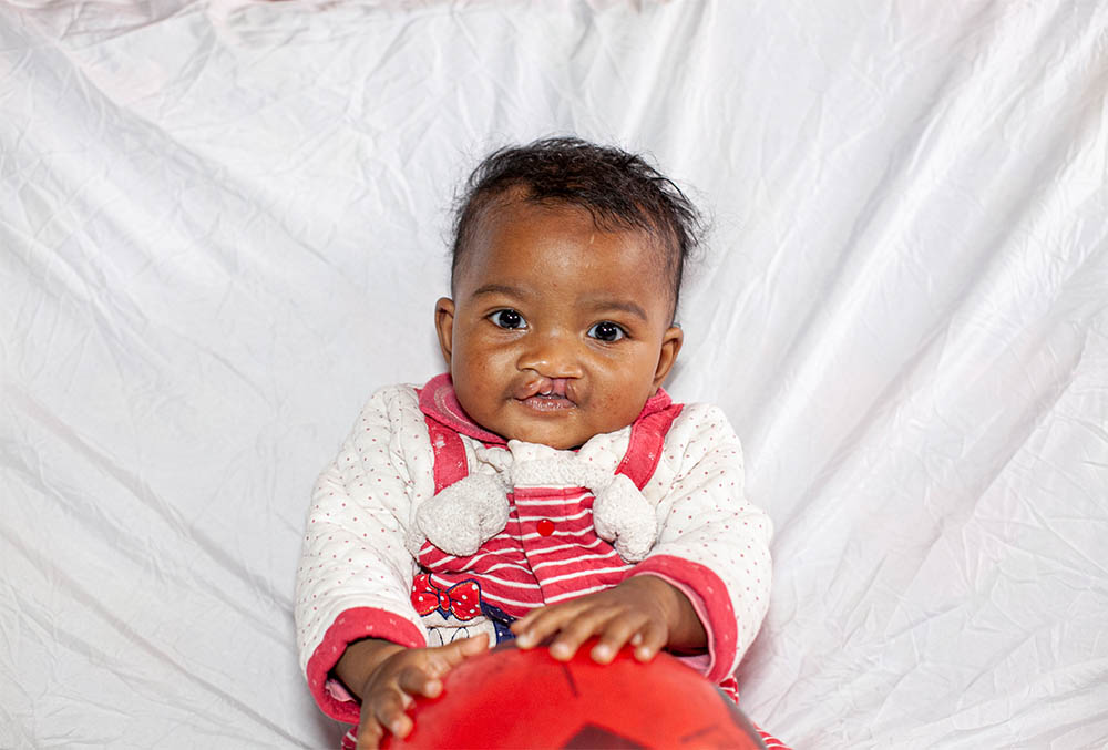 Tsiorihasina as a baby before cleft surgery