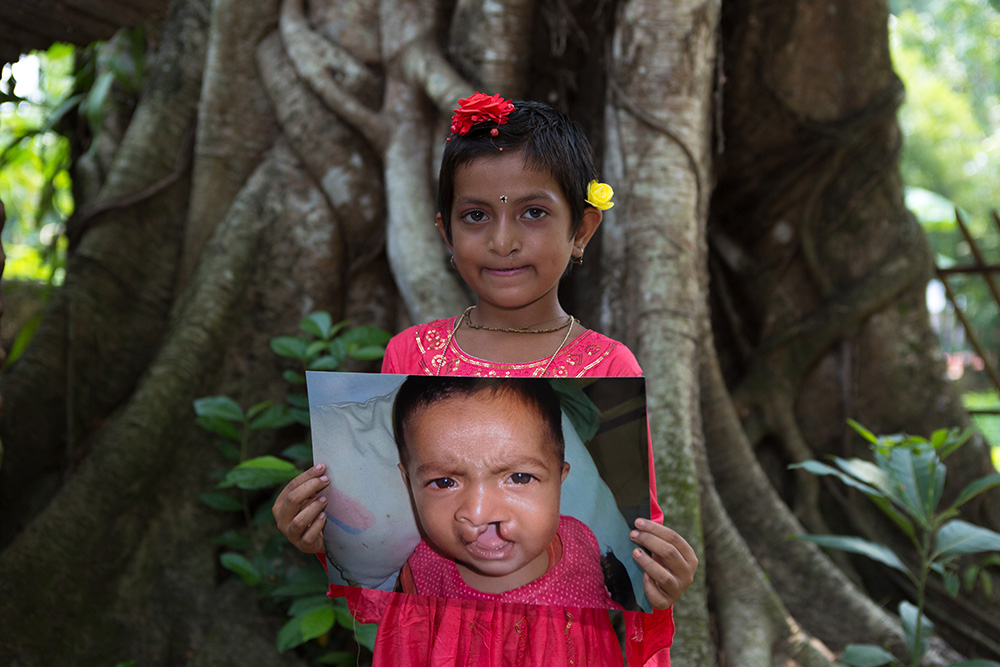 Disha standing in front of a tree holding a photo of herself before her cleft surgery