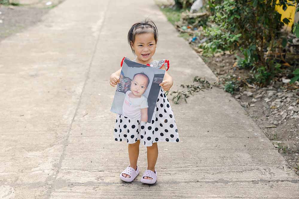 Kaylee holds up her photo from before cleft care