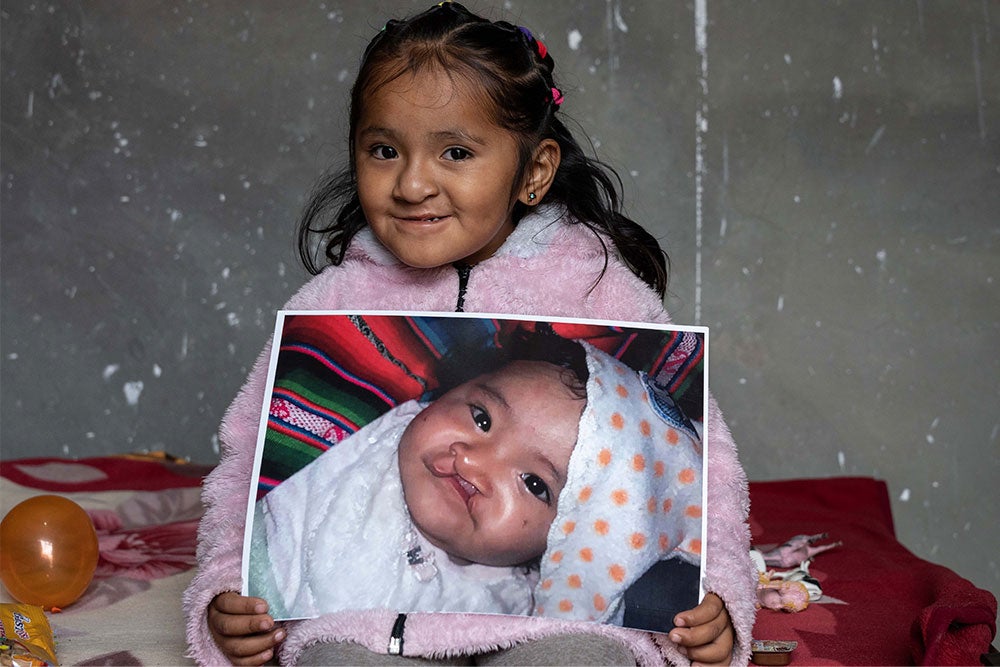 Roselin’s stunning smile makes everyone’s day. Smile Train supporters like you made it possible