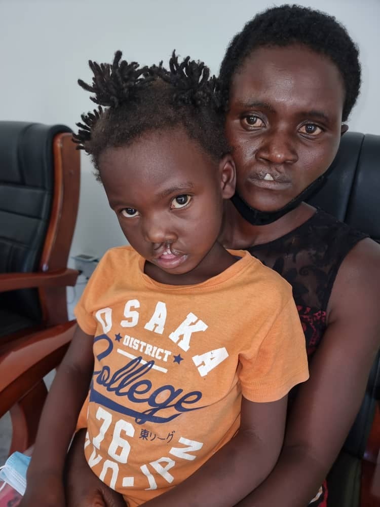 Siriza holding Janerose in her lap just before her cleft surgery Zimbabwe