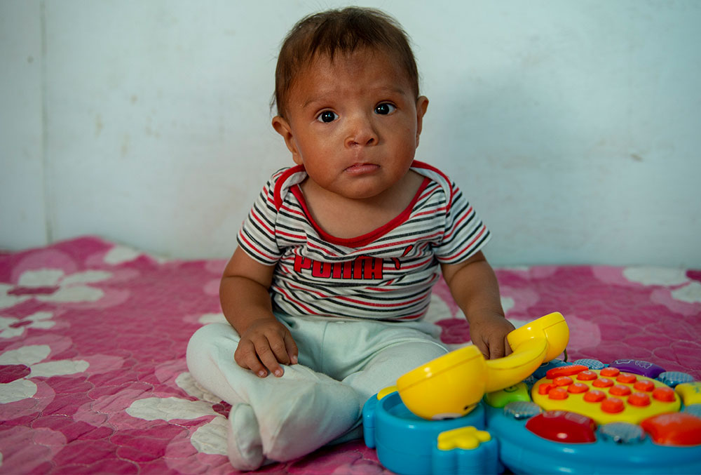 Joseyur playing with a toy shortly after his first cleft surgery