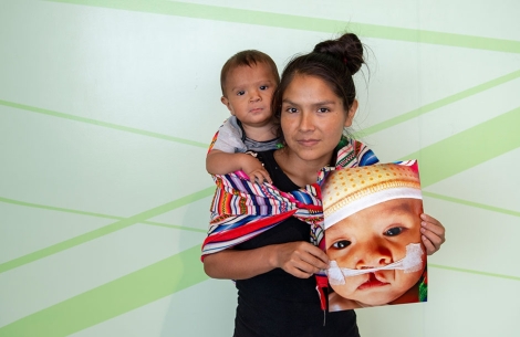 Zindia holds Joseyur in one arm and a picture of him before cleft surgery in the other