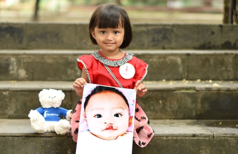 Khalisa holding a picture of herself before cleft surgery