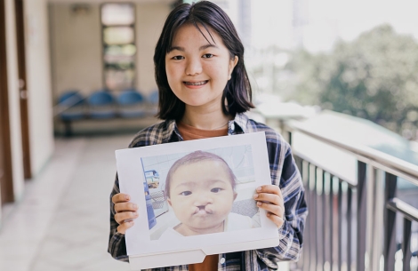 Jian holding a picture of herself as a baby, before cleft surgery