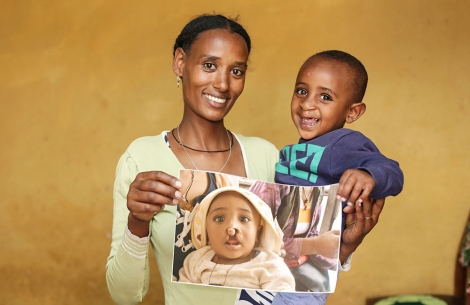 Yohanes and his mother smiling and holding a picture of him before cleft surgery