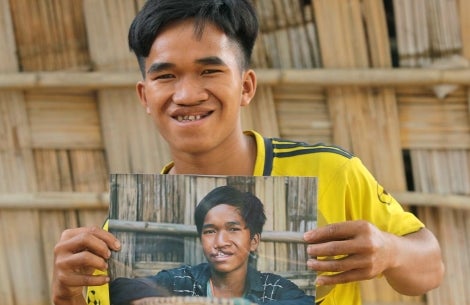 Ray holding a photo of himself before cleft surgery