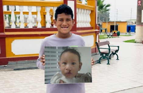 Imanol holding a picture of himself as a baby before his cleft surgeries