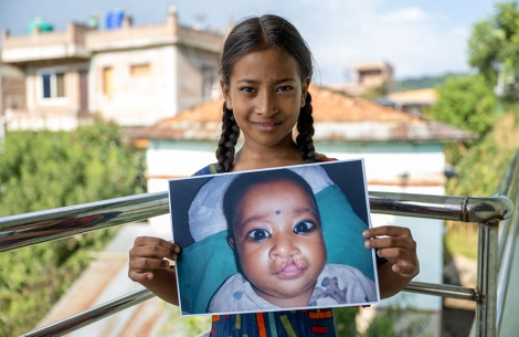 Simrik holding a picture of herself before cleft surgery