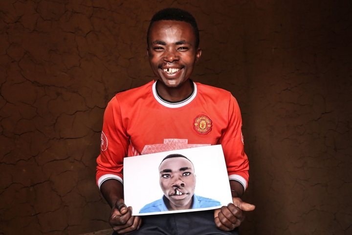 Claude holds image of himself before cleft surgery
