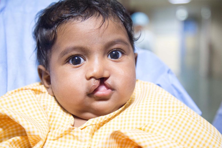 Jaya before surgery