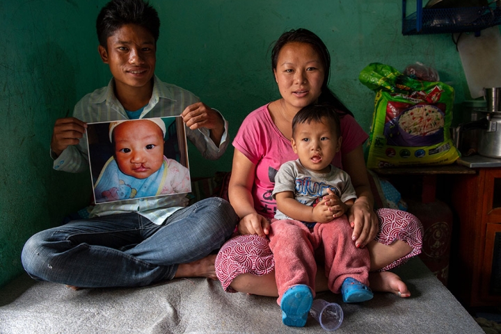 Smile with his family. His dad holds an image of him before Smile Train-sponsored cleft surgery