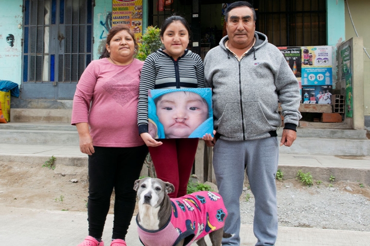 Chiara holding a picture of herself before cleft surgery and standing with her parents and dog