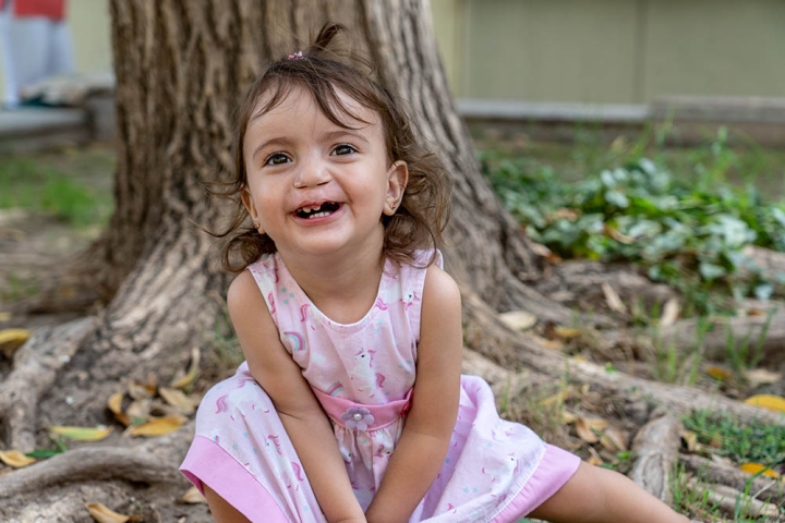 Smile Train patient from Argentina