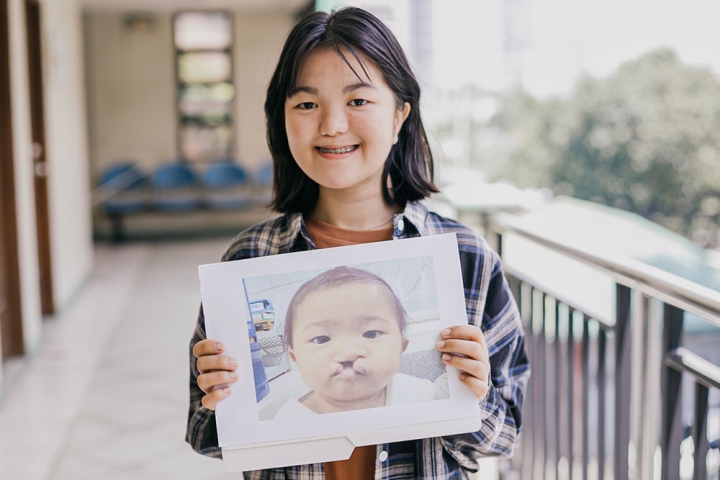 Jian holding a picture of herself as a baby, before cleft surgery