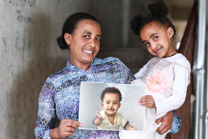 Zinash holding Marsillas and a picture of her before cleft surgery